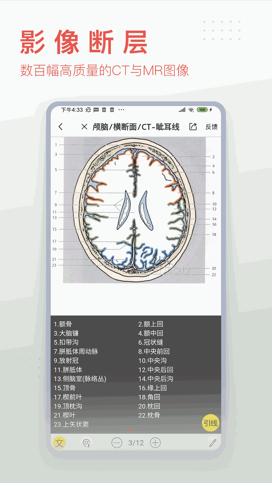 3DBody解剖