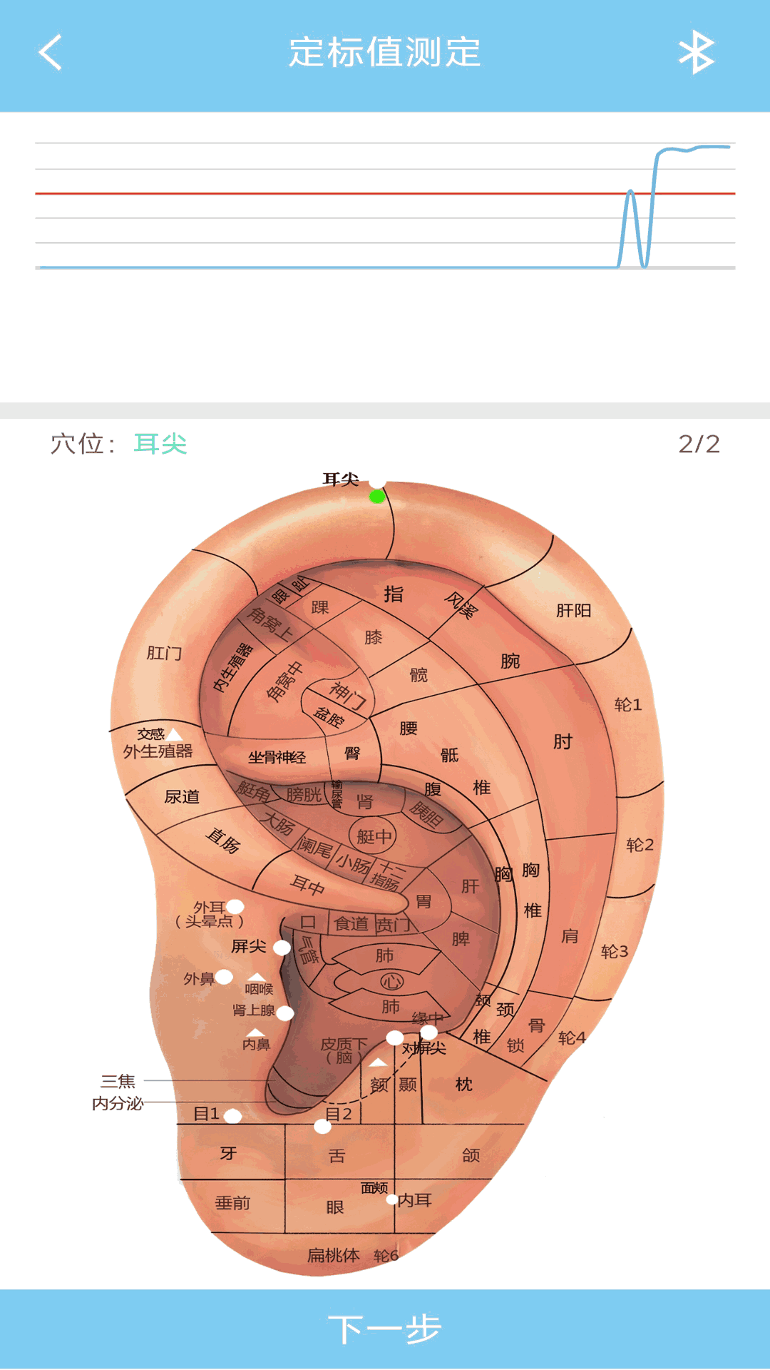 妙郎中耳穴检测